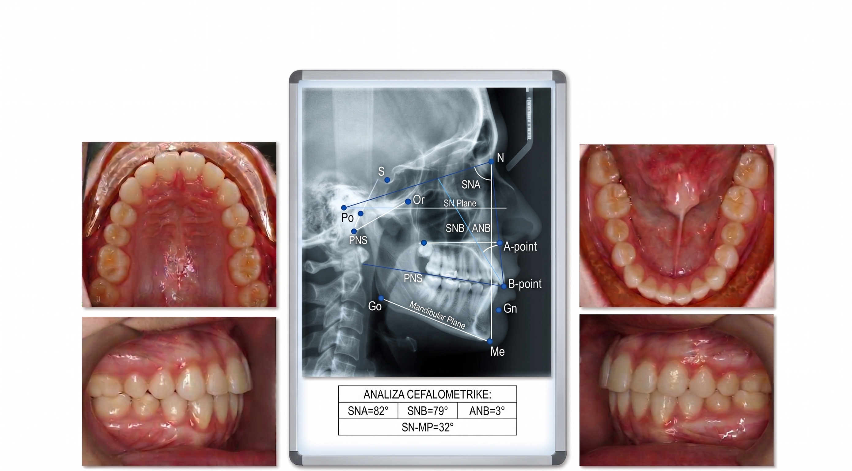 Clinical Photos