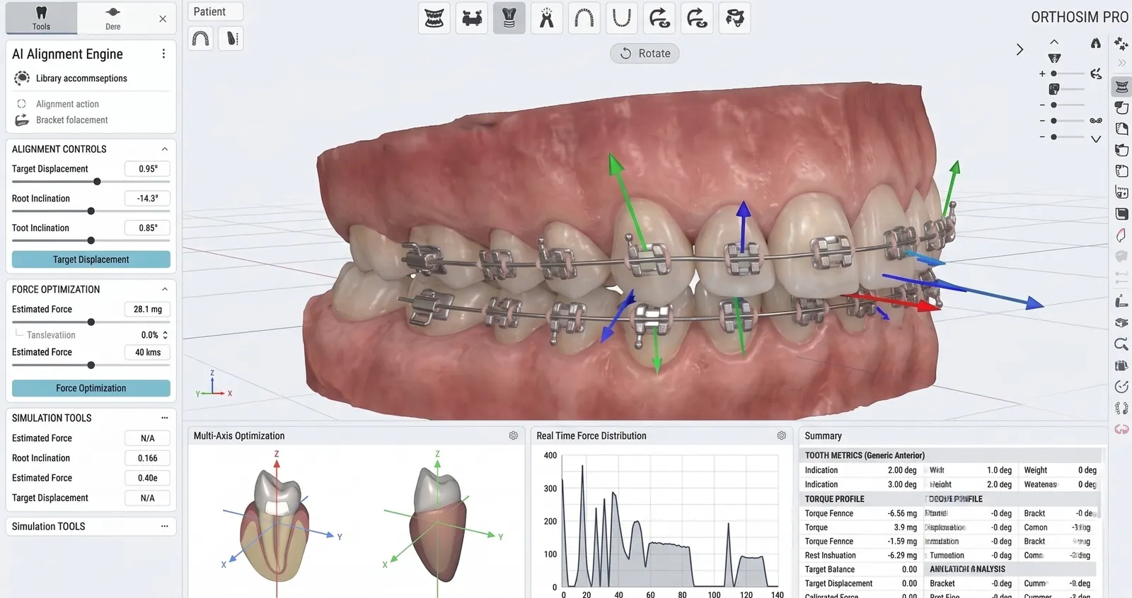 Advanced IDB Dentsplan