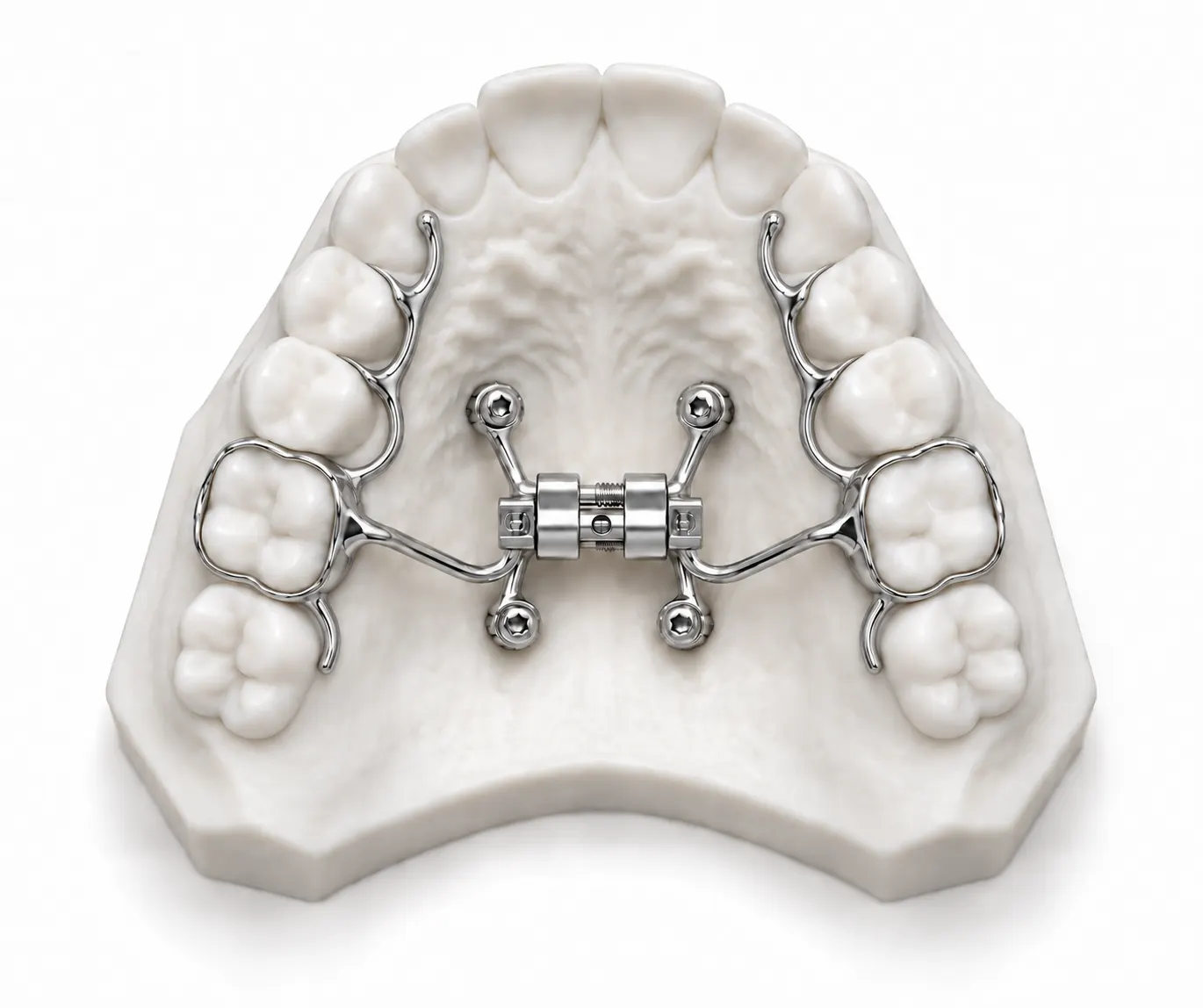 MARPE Dentsplan